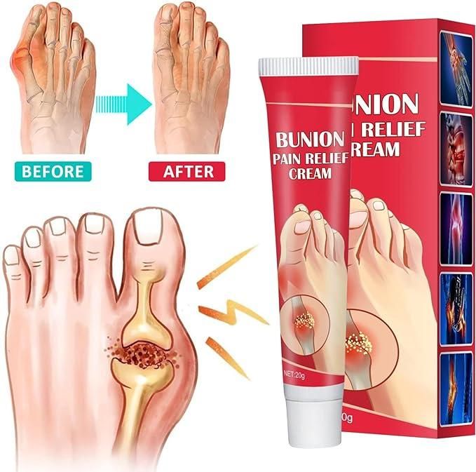 Bunion Pain Relief Cream (Pack Of 1)